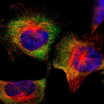 Immunocytochemistry/Immunofluorescence: HLA DQA1 Antibody [NBP1-84550] - Staining of human cell line U-251MG shows positivity in cytoplasm.