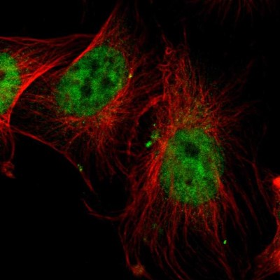Immunocytochemistry/Immunofluorescence: SP1 Antibody [NBP1-85812] - Immunofluorescent staining of human cell line U-251 MG shows localization to nucleoplasm.