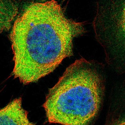 Immunocytochemistry/Immunofluorescence: PP2C epsilon/PPM1L Antibody [NBP1-87247] - Immunofluorescent staining of human cell line A-431 shows localization to cytosol.