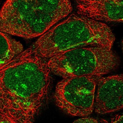 Immunocytochemistry/Immunofluorescence: ARFIP2 Antibody [NBP1-87255] - Staining of human cell line A-431 shows positivity in nucleus, nucleoli and golgi apparatus.