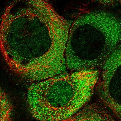 Immunocytochemistry/Immunofluorescence: KIAA1609 Antibody [NBP1-86235] - Immunofluorescent staining of human cell line A-431 shows localization to nucleoplasm & cytosol.