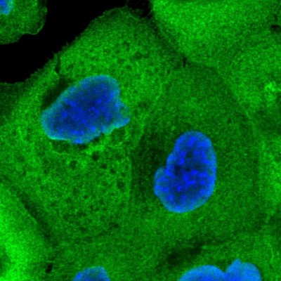 Immunocytochemistry/Immunofluorescence: CALML5 Antibody [NBP1-84437] - Immunofluorescent staining of human cell line A-431 shows localization to plasma membrane & cytosol.