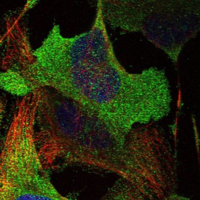 Immunocytochemistry/Immunofluorescence: ADCK5 Antibody [NBP1-83500] - Immunofluorescent staining of human cell line U-2 OS shows localization to plasma membrane & cytosol.