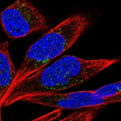 Immunocytochemistry/Immunofluorescence: PTPRD Antibody [NBP2-49153] - Immunofluorescent staining of human cell line RH-30 shows localization to vesicles.