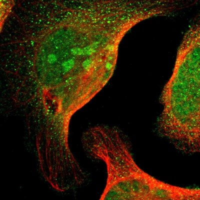 Immunocytochemistry/Immunofluorescence: MED27 Antibody [NBP1-84377] - Immunofluorescent staining of human cell line U-2 OS shows localization to nucleus, nucleoli & cytosol.