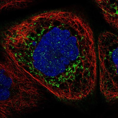 Immunocytochemistry/Immunofluorescence: ALDH7A1 Antibody [NBP1-88908] - Immunofluorescent staining of human cell line A-431 shows localization to mitochondria.