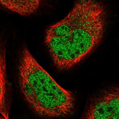 Immunocytochemistry/Immunofluorescence: BTBD6 Antibody [NBP1-88672] - Immunofluorescent staining of human cell line U-2 OS shows localization to nucleoplasm.