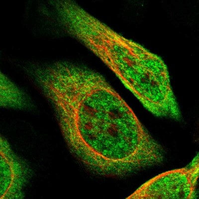 Immunocytochemistry/Immunofluorescence: ZBTB2 Antibody [NBP1-88786] - Immunofluorescent staining of human cell line U-2 OS shows localization to nucleoplasm & cytosol.