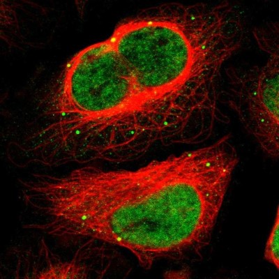 Immunocytochemistry/Immunofluorescence: MEF2D Antibody [NBP1-85795] - Immunofluorescent staining of human cell line U-2 OS shows localization to nucleoplasm & vesicles.