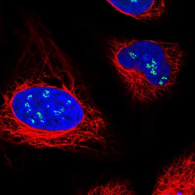 Immunocytochemistry/Immunofluorescence: Treacher Collins syndrome protein Antibody [NBP1-86908] - Immunofluorescent staining of human cell line U-2 OS shows localization to nucleoli fibrillar center.