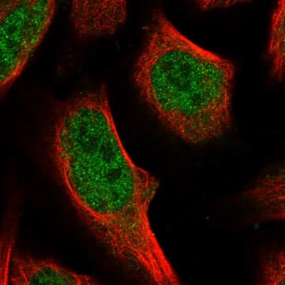 Immunocytochemistry/Immunofluorescence: wdyhv1 Antibody [NBP1-86722] - Immunofluorescent staining of human cell line U-2 OS shows localization to nucleoplasm.