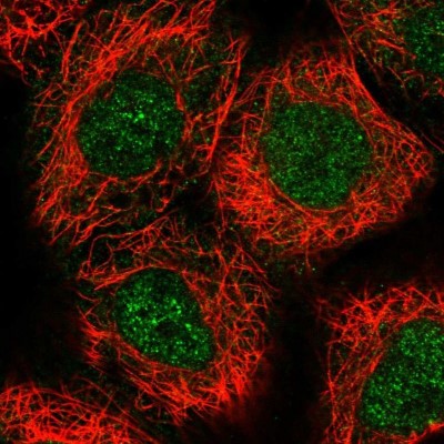 Immunocytochemistry/Immunofluorescence: Archaemetzincin 2 Antibody [NBP1-85996] - Staining  of human cell line A-431 shows positivity in nucleus but not nucleoli.