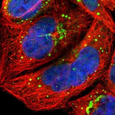 Immunocytochemistry/Immunofluorescence: PIPPIN Antibody [NBP1-87271] - Staining of human cell line A-431 shows positivity in nucleus but not nucleoli, golgi apparatus and vesicles.