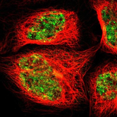 Immunocytochemistry/Immunofluorescence: GAB3 Antibody [NBP1-86111] - Staining  of human cell line A-431 shows positivity in nucleus but not nucleoli.