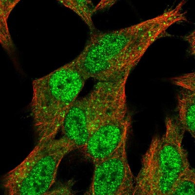 Immunocytochemistry/Immunofluorescence: SV2C Antibody [NBP1-85849] - Immunofluorescent staining of human cell line SH-SY5Y shows localization to nucleoplasm, cytosol & vesicles.
