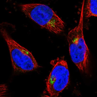 Immunocytochemistry/Immunofluorescence: CYB5R2 Antibody [NBP1-85865] - Immunofluorescent staining of human cell line U-251 MG shows localization to the Golgi apparatus.