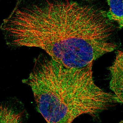Immunocytochemistry/Immunofluorescence: GPR142 Antibody [NBP1-87286] - Immunofluorescent staining of human cell line U-251 MG shows localization to plasma membrane & cytosol.