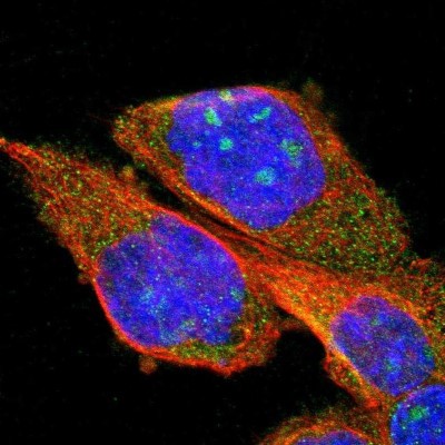Immunocytochemistry/Immunofluorescence: PPM1B Antibody [NBP1-87250] - Staining of human cell line A-431 shows positivity in nucleoli and cytoplasm.