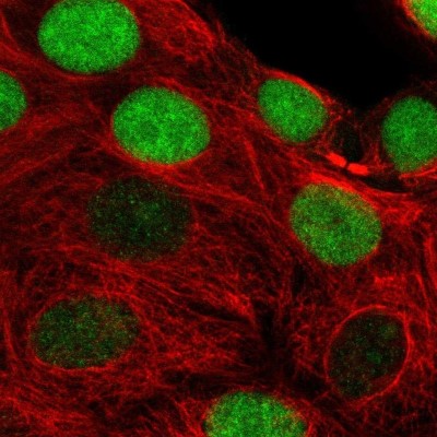 Immunocytochemistry/Immunofluorescence: Timeless Antibody [NBP2-32559] - Staining of human cell line MCF7 shows localization to nucleus.