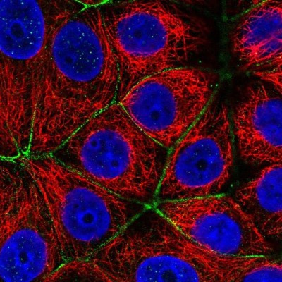 Immunocytochemistry/Immunofluorescence: PARD6A Antibody [NBP2-38487] - Staining of human cell line MCF7 shows localization to actin filaments & cell junctions.