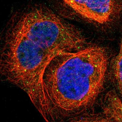 Immunocytochemistry/Immunofluorescence: PHD4/HIF Prolyl Hydroxylase 4 Antibody [NBP1-83989] - Staining of human cell line A-431 shows positivity in cytoplasm and vesicles.