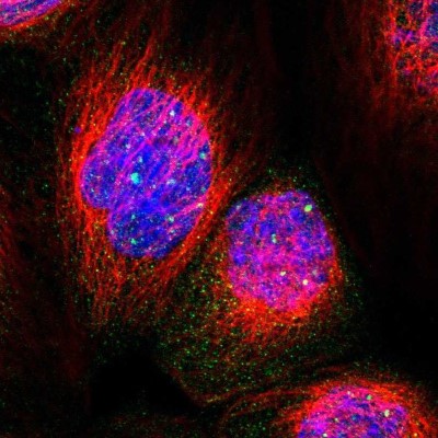Immunocytochemistry/Immunofluorescence: PPWD1 Antibody [NBP1-83049] - Immunofluorescent staining of human cell line A-431 shows localization to nuclear bodies.