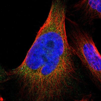 Immunocytochemistry/Immunofluorescence: JWA Antibody [NBP1-84273] - Immunofluorescent staining of human cell line U-251 MG shows localization to endoplasmic reticulum.