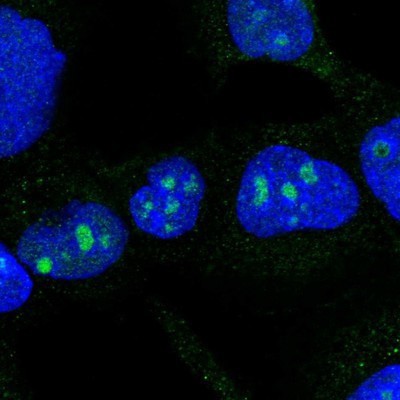Immunocytochemistry/Immunofluorescence: DDX50 Antibody [NBP1-83311] - Staining of human cell line A-431 shows positivity in nucleoli.