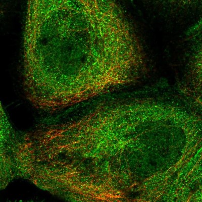 Immunocytochemistry/Immunofluorescence: RILPL1 Antibody [NBP1-81928] - Immunofluorescent staining of human cell line A-431 shows localization to nucleoplasm, plasma membrane & cytosol.