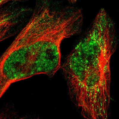 Immunocytochemistry/Immunofluorescence: TRMT12 Antibody [NBP1-83633] - Immunofluorescent staining of human cell line U-2 OS shows localization to nucleoplasm & mitochondria.
