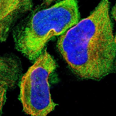 Immunocytochemistry/Immunofluorescence: NMT1 Antibody [NBP1-82548] - Immunofluorescent staining of human cell line U-2 OS shows localization to plasma membrane & cytosol.