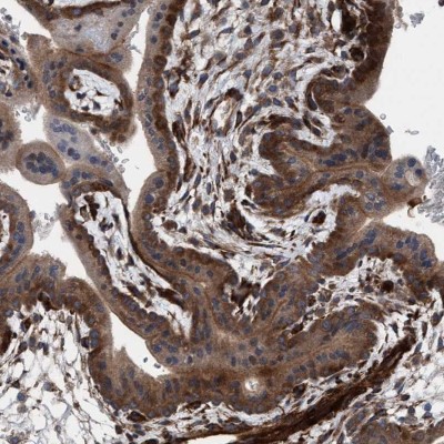 Immunocytochemistry/Immunofluorescence: NMT1 Antibody [NBP1-82548] - Staining of human placenta shows cytoplasmic positivity in trophoblastic cells.