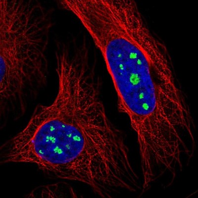 Immunocytochemistry/Immunofluorescence: LRRC40 Antibody [NBP1-82185] - Immunofluorescent staining of human cell line U-2 OS shows localization to nucleoli.