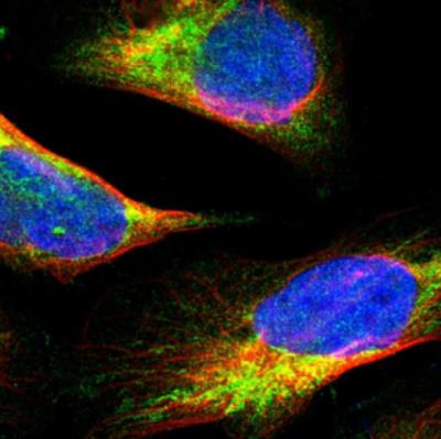 Immunocytochemistry/Immunofluorescence: WASF1/WAVE1 Antibody [NBP1-83018] - Staining  of human cell line U-2 OS shows positivity in mitochondria. Antibody staining is shown in green.