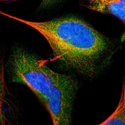 Immunocytochemistry/Immunofluorescence: GALK1 Antibody [NBP1-81853] - Immunofluorescent staining of human cell line U-2 OS shows localization to cytosol.