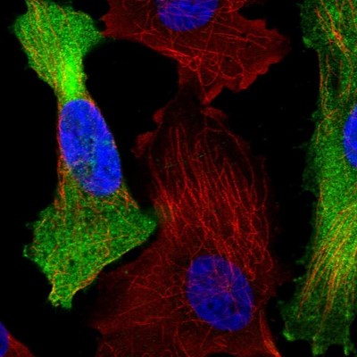 Immunocytochemistry/Immunofluorescence: C1orf74 Antibody [NBP1-83571] - Immunofluorescent staining of human cell line U-251 MG shows localization to plasma membrane & cytosol.