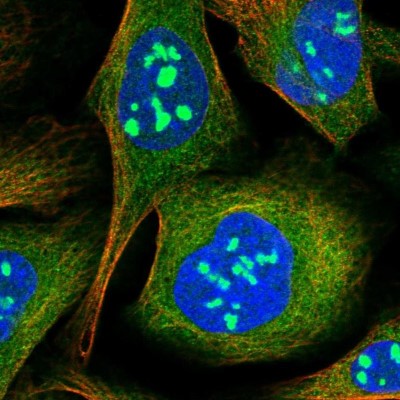 Immunocytochemistry/Immunofluorescence: ZNF397 Antibody [NBP1-82753] - Staining of human cell line U-2 OS shows positivity in nucleoli, plasma membrane, cytoplasm and cytoskeleton (microtubules).