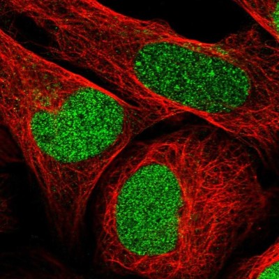 Immunocytochemistry/Immunofluorescence: MDH1B Antibody [NBP1-83564] - Staining of human cell line U-2 OS shows positivity in nucleus but not nucleoli.