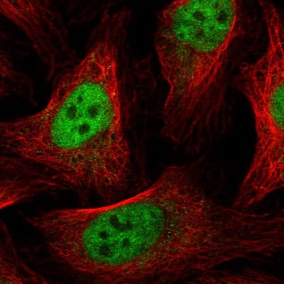 Immunocytochemistry/Immunofluorescence: GABPA Antibody [NBP1-84941] - Immunofluorescent staining of human cell line U-2 OS shows localization to nucleoplasm.