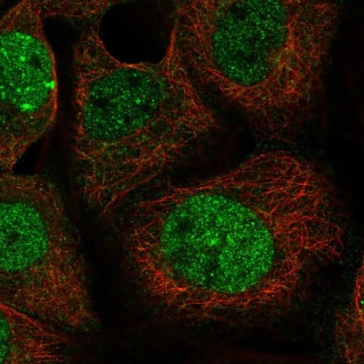 Immunocytochemistry/Immunofluorescence: LETM2 Antibody [NBP1-83563] - Staining of human cell line A-431 shows localization to nucleoplasm & nuclear bodies.