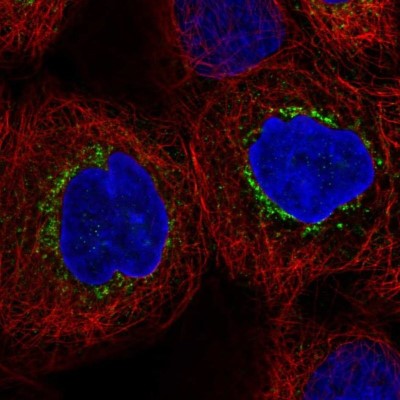 Immunocytochemistry/Immunofluorescence: Clathrin Heavy Chain 1/CHC17 Antibody [NBP2-49293] - Analysis of human cell line A-431 shows positivity in vesicles.