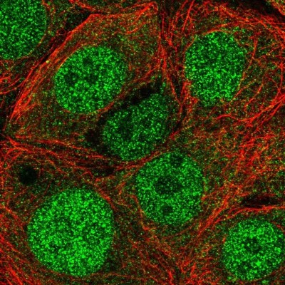 Immunocytochemistry/Immunofluorescence: EIF3B Antibody [NBP2-38597] - Staining of human cell line MCF7 shows localization to nucleoplasm & cytosol.