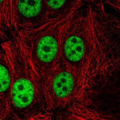 Immunocytochemistry/Immunofluorescence: CCDC12 Antibody [NBP2-30374] - Immunofluorescent staining of human cell line MCF7 shows localization to nucleoplasm.
