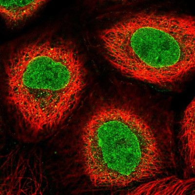 Immunocytochemistry/Immunofluorescence: AKD1 Antibody [NBP2-33936] - Immunofluorescent staining of human cell line A-431 shows localization to nucleoplasm & nuclear membrane.