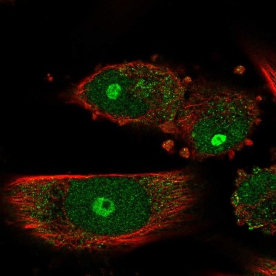 Immunocytochemistry/Immunofluorescence: GNL3L Antibody [NBP2-32660] - Immunofluorescent staining of human cell line U-251 MG shows localization to nucleus, nucleoli & cytosol.