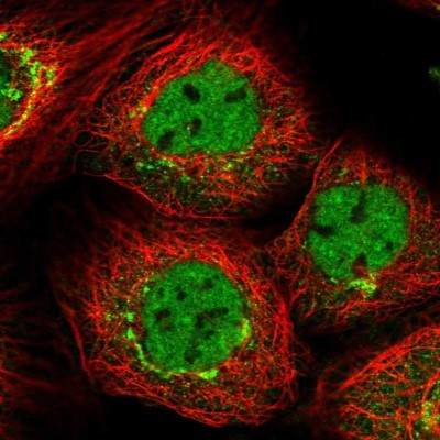 Immunocytochemistry/Immunofluorescence: PPHLN1 Antibody [NBP2-38431] - Staining of human cell line A-431 shows localization to nucleoplasm & the Golgi apparatus.