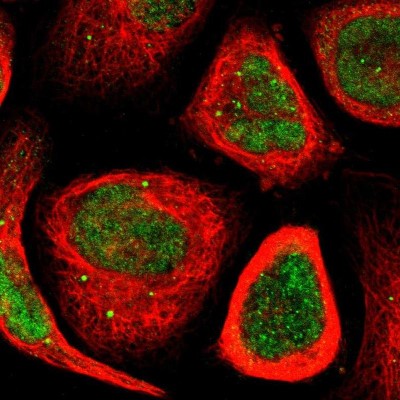 Immunocytochemistry/Immunofluorescence: MYEOV Antibody [NBP1-80974] - Immunofluorescent staining of human cell line A-431 shows localization to nucleus & vesicles.