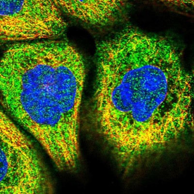 Immunocytochemistry/Immunofluorescence: TEX9 Antibody [NBP1-86249] - Immunofluorescent staining of human cell line A-431 shows localization to cytosol.