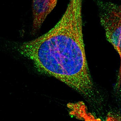 Immunocytochemistry/Immunofluorescence: HPRT Antibody [NBP1-92006] - Immunofluorescent staining of human cell line U-2 OS shows localization to cytosol.