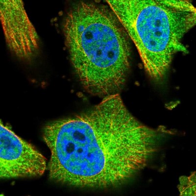 Immunocytochemistry/Immunofluorescence: COASY Antibody [NBP1-84991] - Immunofluorescent staining of human cell line U-251 MG shows localization to nucleoplasm & cytosol.